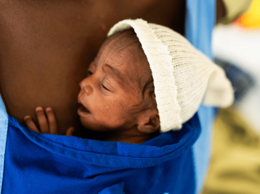 A premature baby is held in a "kangaroo pouch" at a hospital in Nigeria.